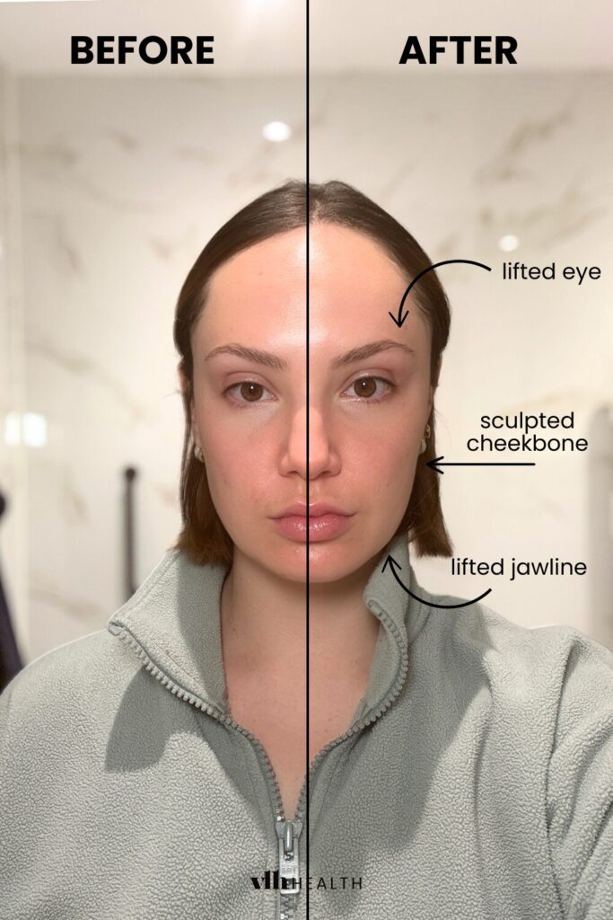 Microcurrent facial before and after comparison showing lifted eye, sculpted cheekbone, and defined jawline.